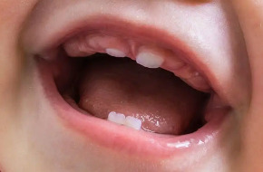 Odontopediatria Odontopediatria