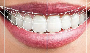 Odontologia Estetica Odontologia Estetica